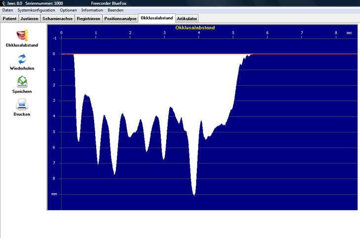 JAWS Okklusalabstand