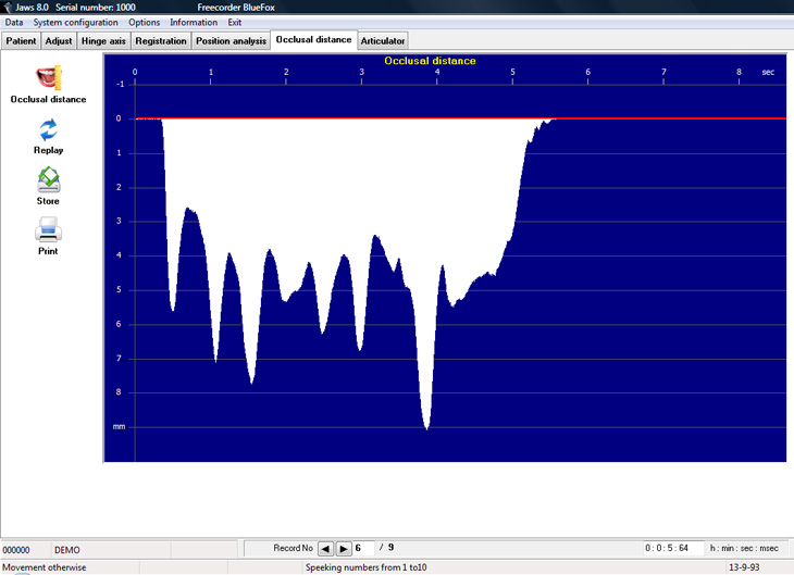 JAWS occlusal distance